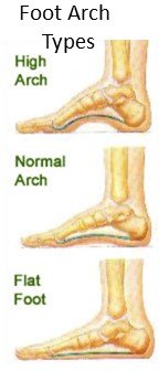 How To Measure Foot For Shoe Size Another View Of Foot Arch Types